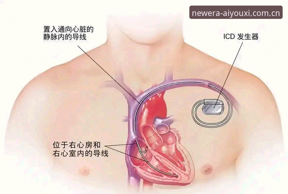 爱游戏体育新版赛事数据安装教程 34岁埃里克森再倒下:五年两次昏厥背后,心脏除颤器如何改写他的职业生涯